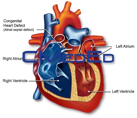 heart conditions